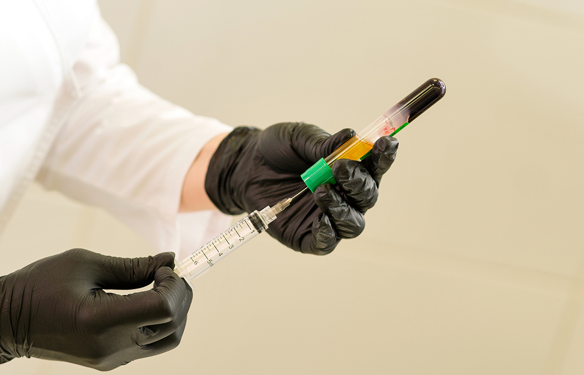 prp1